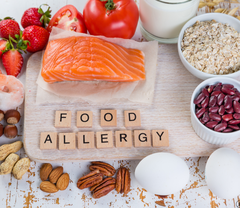 Checkers Allergen Menu